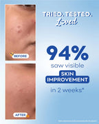Barrier Boost Serum