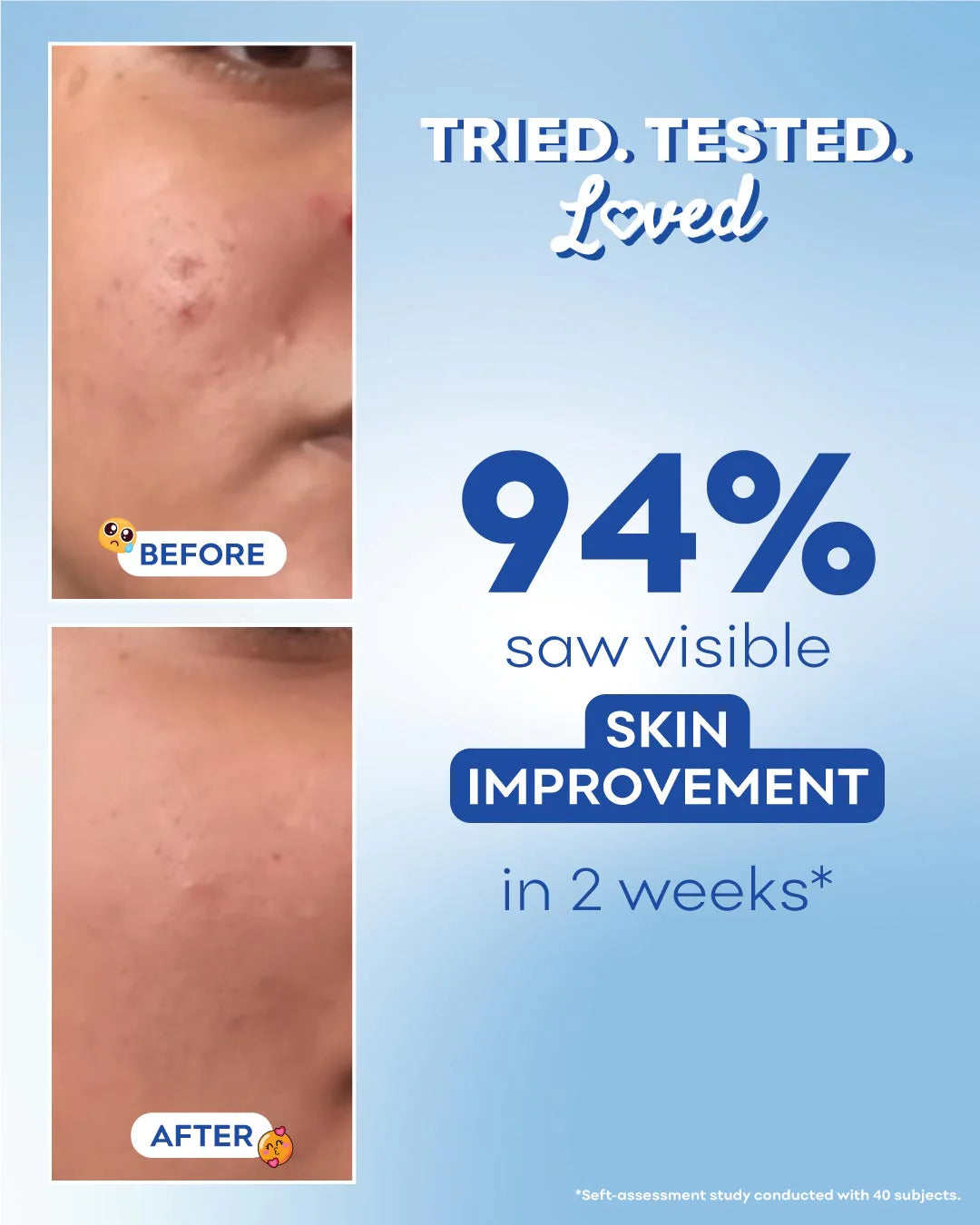 Barrier Boost Serum