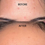 AHA BHA Exfoliating Treatment