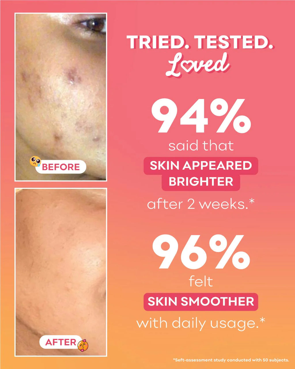 Peachcinamide TXA Serum (6% Niacinamide, 4% TXA)