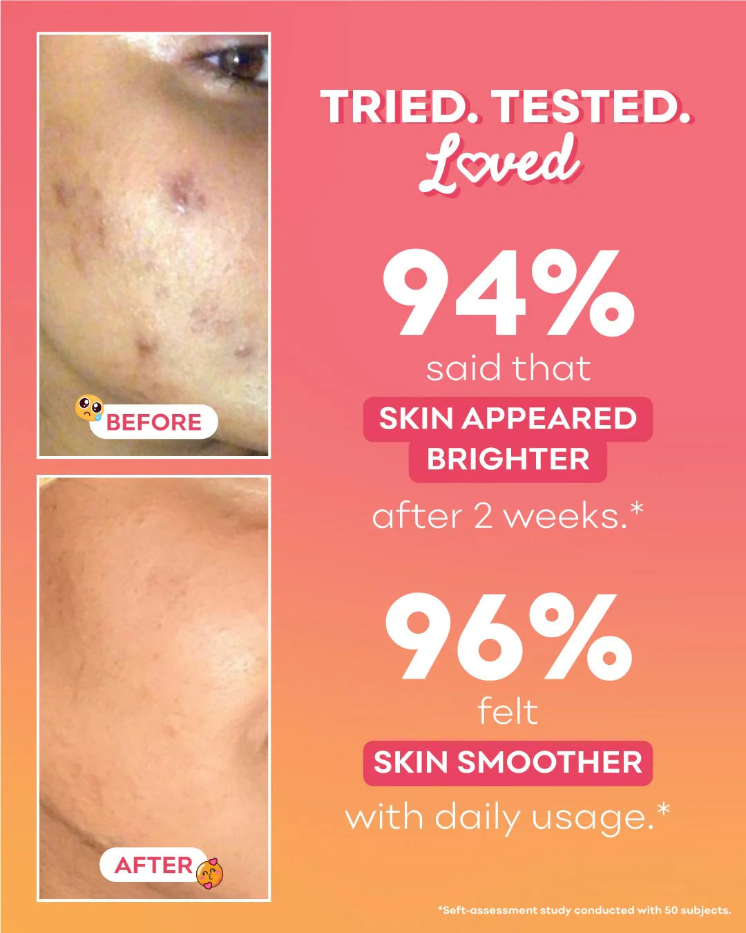 Peachcinamide TXA Serum (6% Niacinamide, 4% TXA)