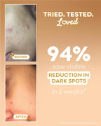 Rice Brightening Serum