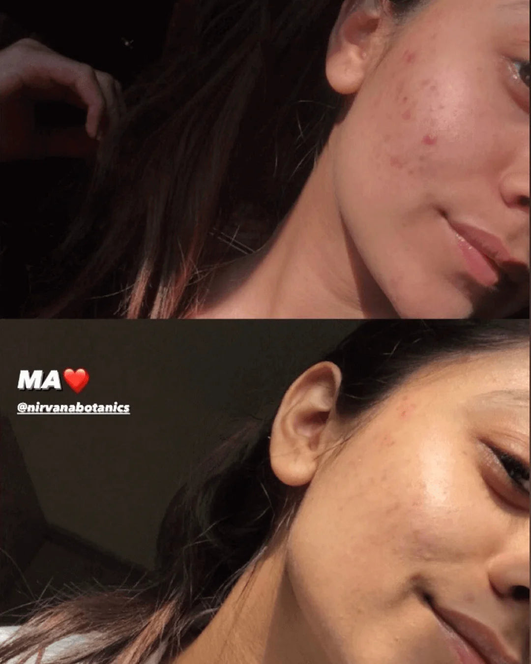 Cloud Oil Free Gel Moisturizer